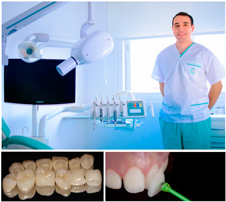 rehab-intreg-estetica-foto-debajo-de-la-sonrisa